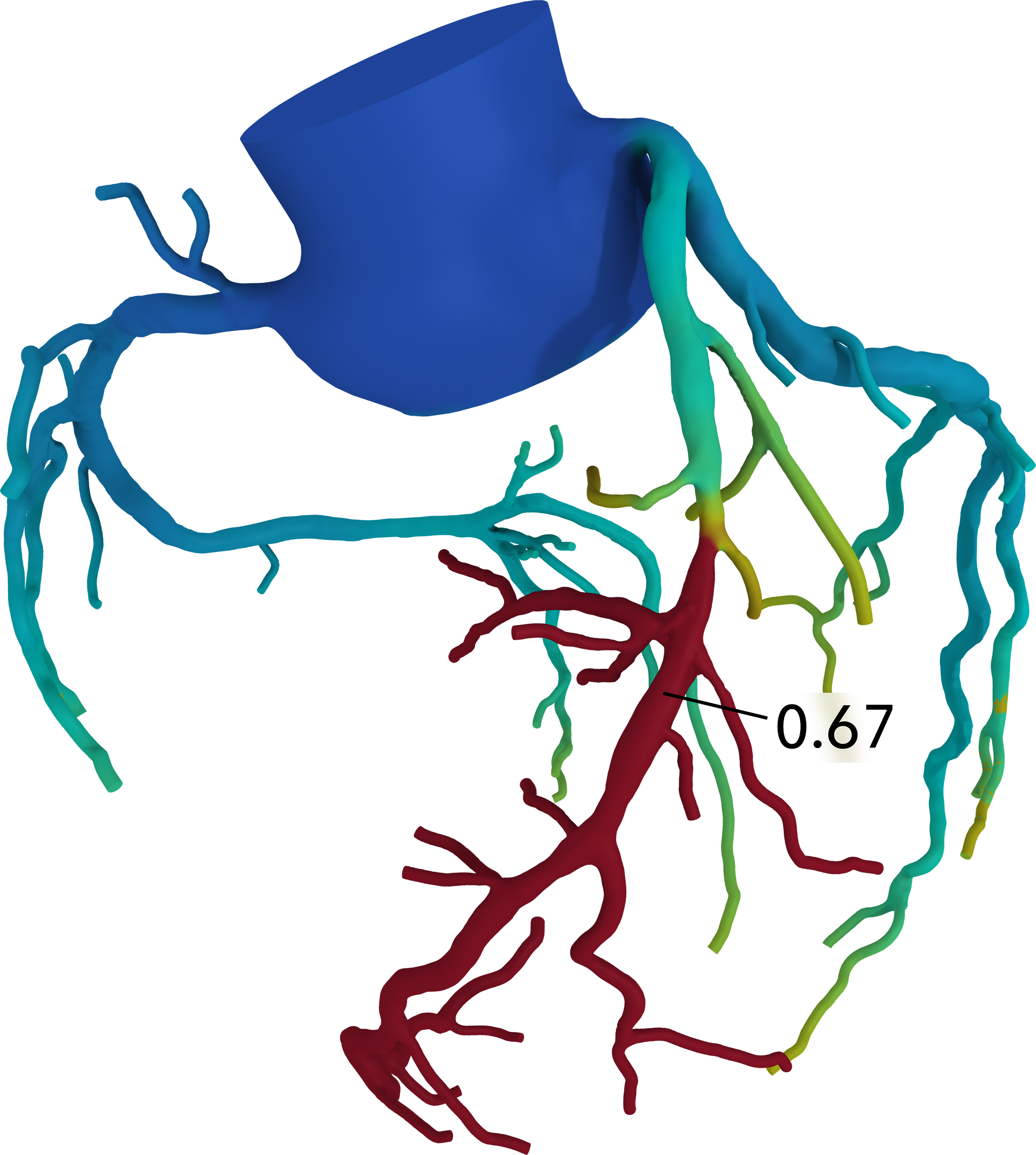 3D Color-Coded Model 